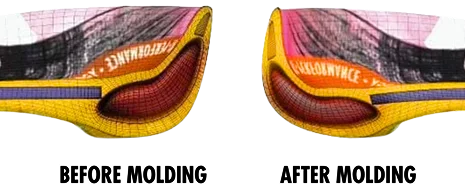 gc-fp-inslole-before-after