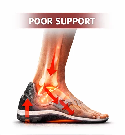 poor-support-insole